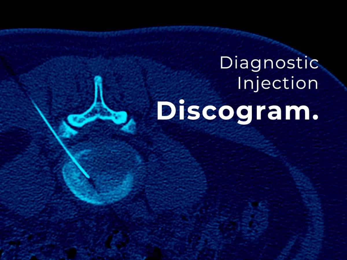 Discogram injection
