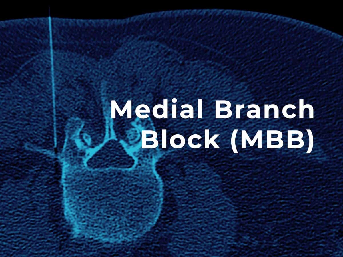 CT scan of a medial branch block injection
