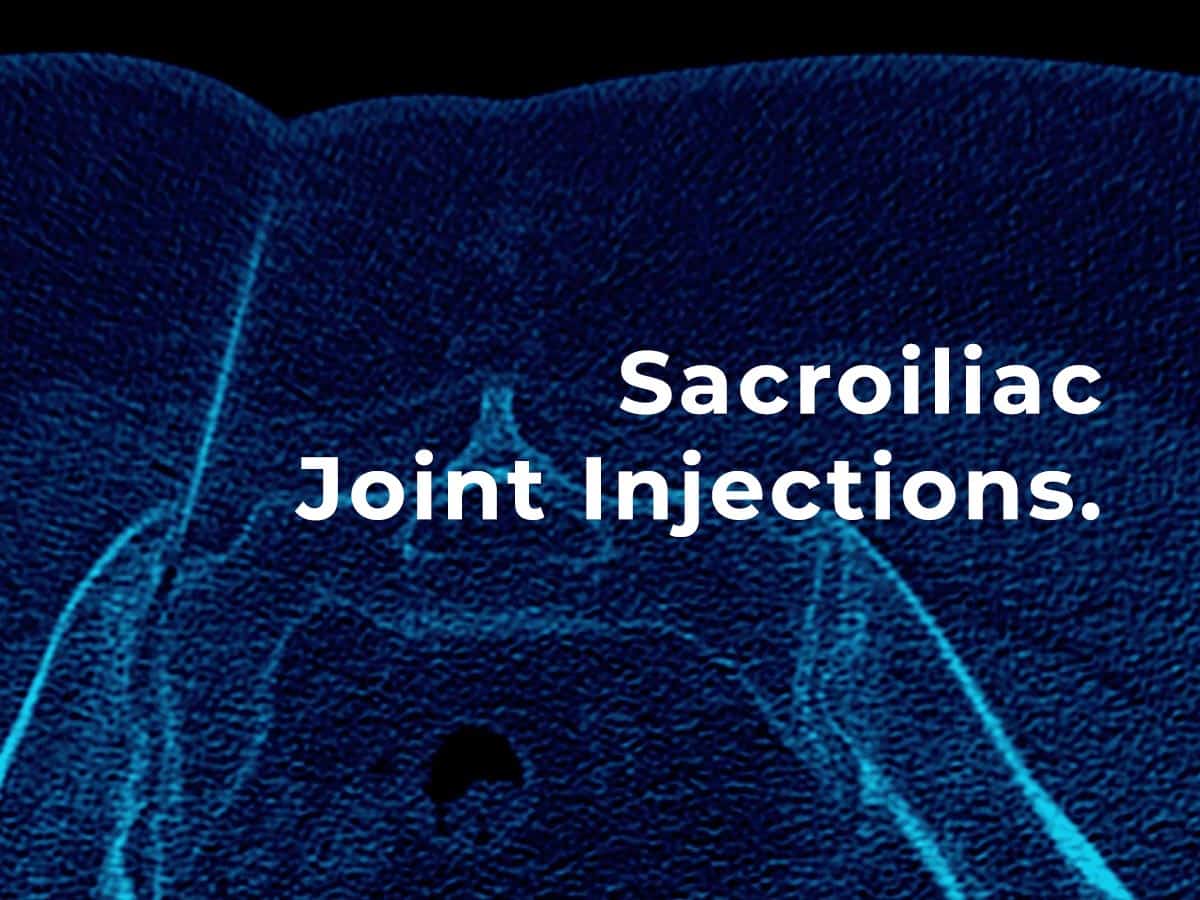 Sacroiliac joint (SIJ) injections - Patient Guide