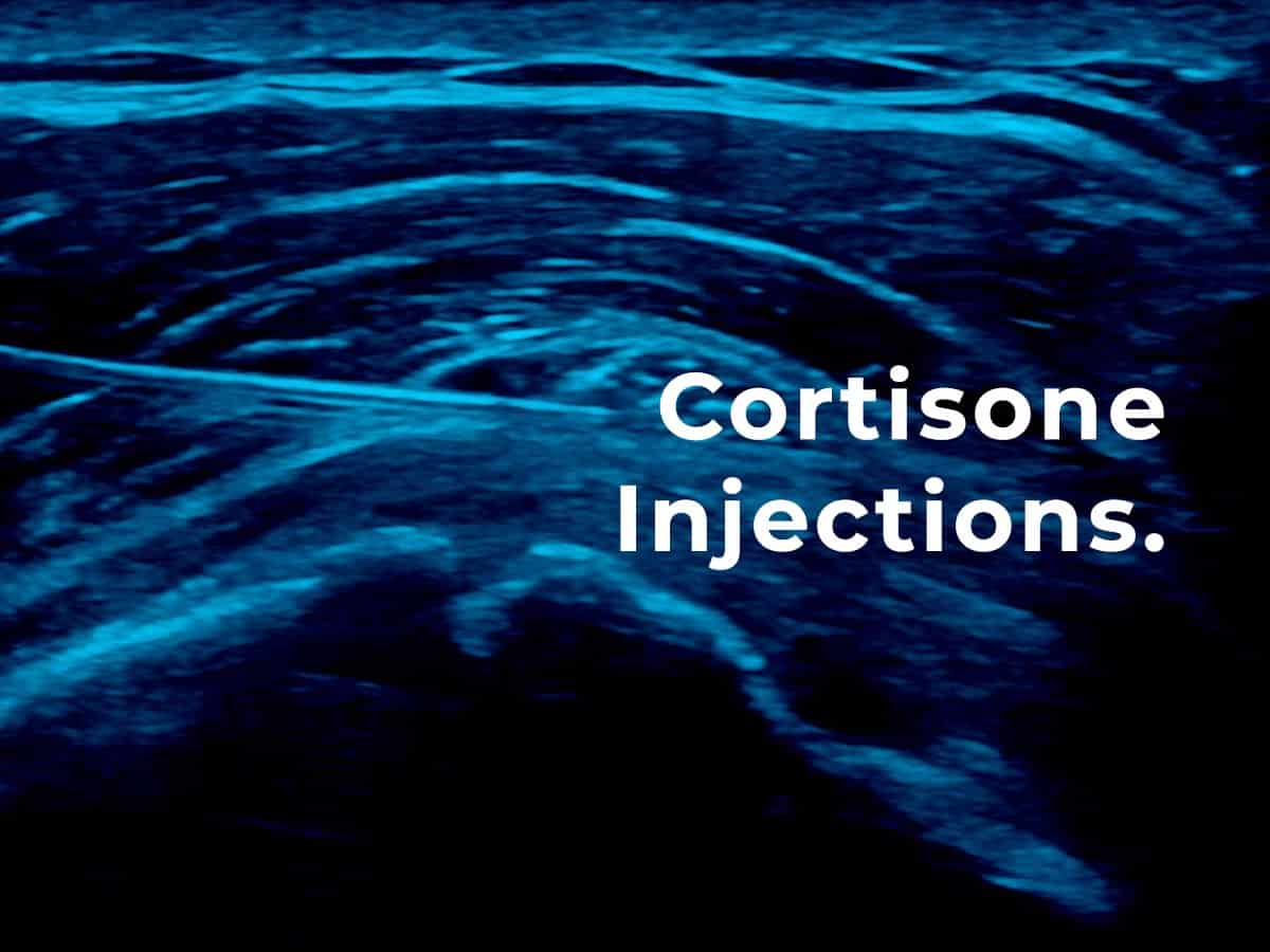 Cortisone Injections