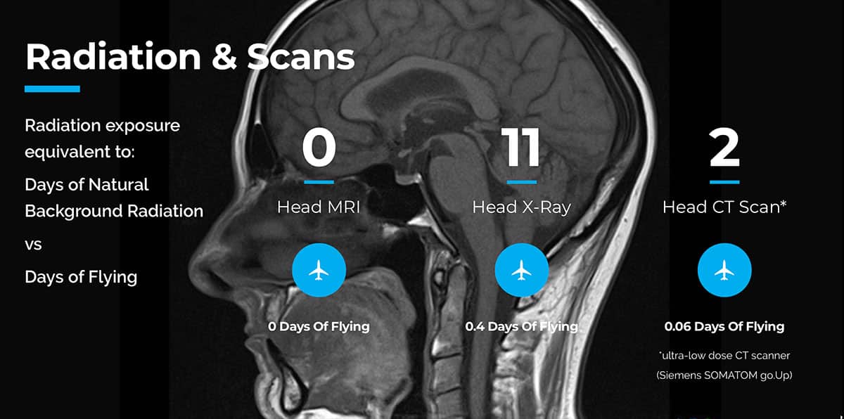MRI, X-ray, and CT scan radiation exposures of the head