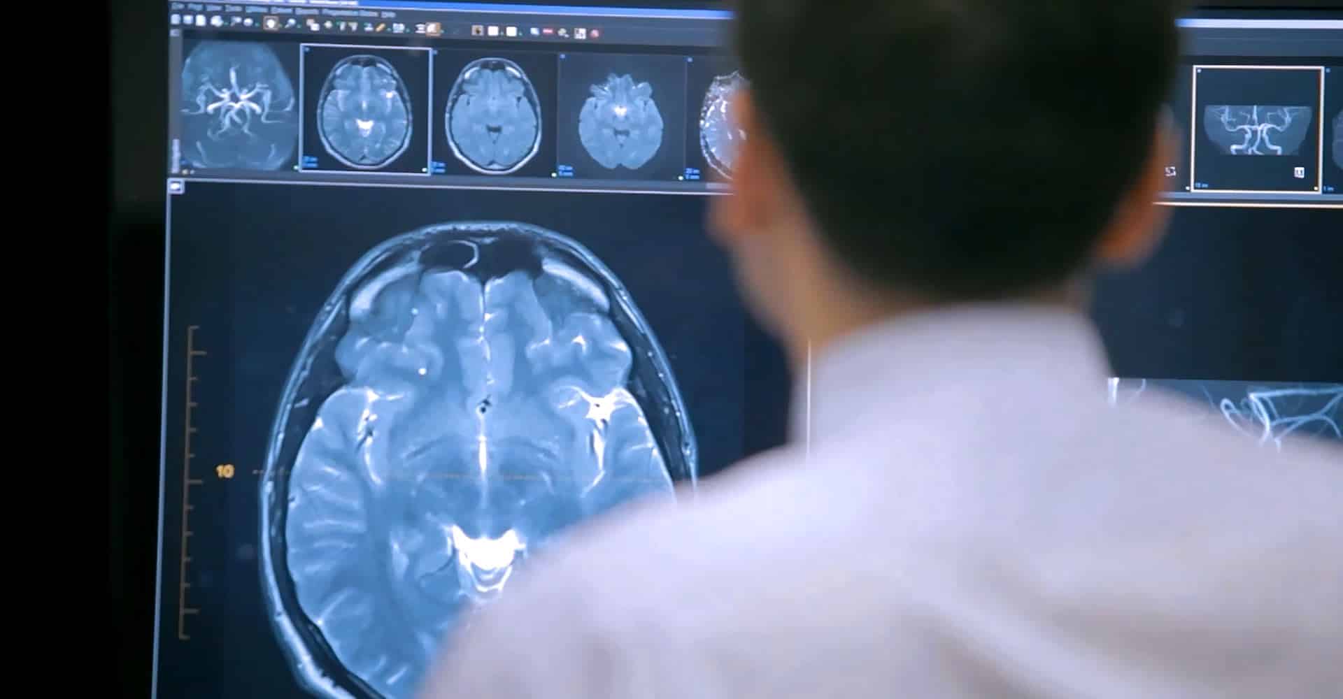 radiologist looking at MRI scans of a brain
