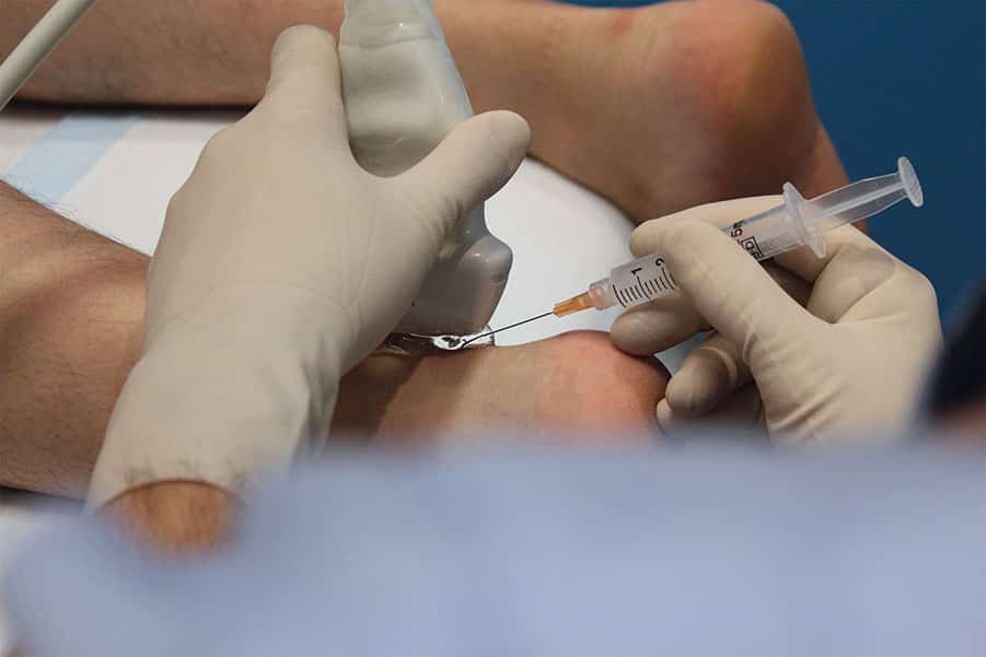 Ultrasound guided injection into the Achilles tendon