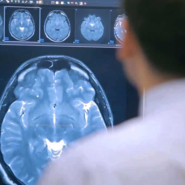 a male doctor looking at brain MRI scans