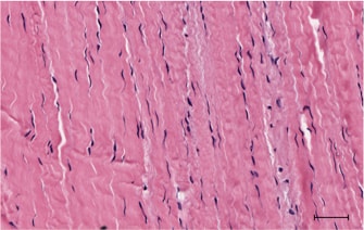 Figure 1 A. Microscopic slide showing normal tenocytes (blue ovoid spindle shape cells) surrounded by strands of dense collagen fibres which provide a tendon with its tensile strength.