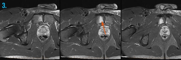 CT scans of the groin