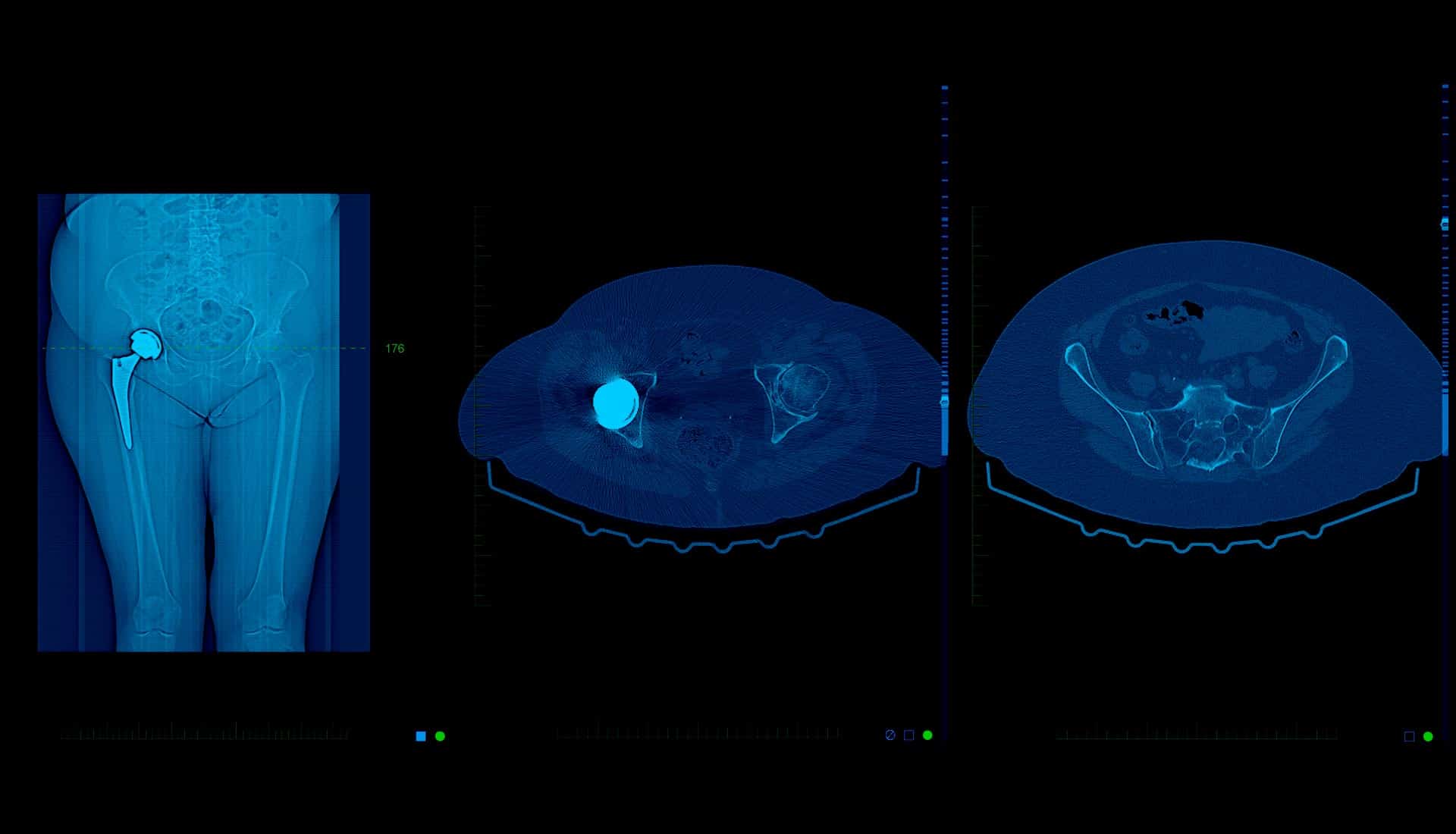 Preparation For Low Dose Ct Scan Melbourne Radiology