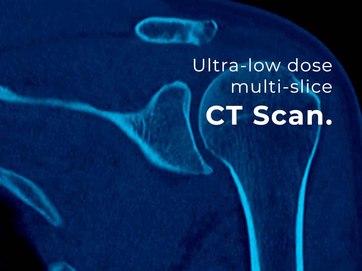 CT Scan - Patient Guide